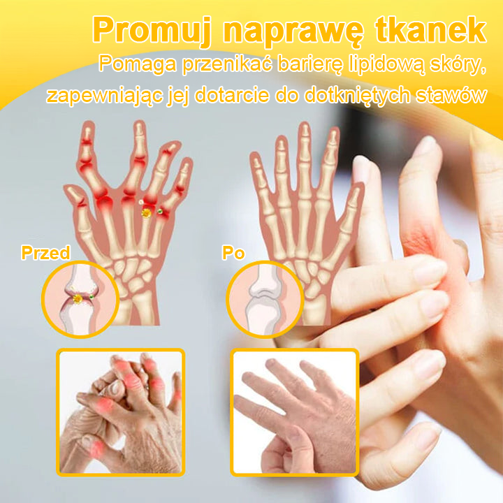 🐝TLOPA® Toksyna botulinowa i jad pszczeli Krem przeciwbólowy do gojenia kości🐝