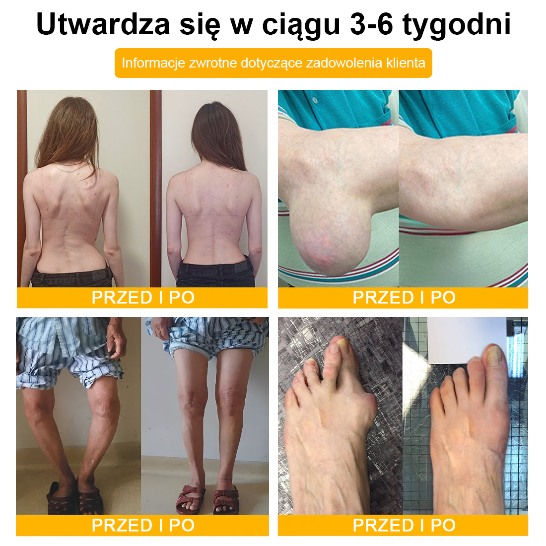 🐝TLOPA® Toksyna botulinowa i jad pszczeli Krem przeciwbólowy do gojenia kości🐝