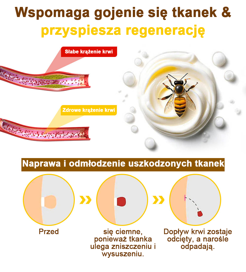 ✅flysmus™ Krem leczniczy z jadem pszczelim🐝: Leczenie egzemy, łuszczycy, trądziku, trądziku różowatego, infekcji grzybiczych, brodawek✅