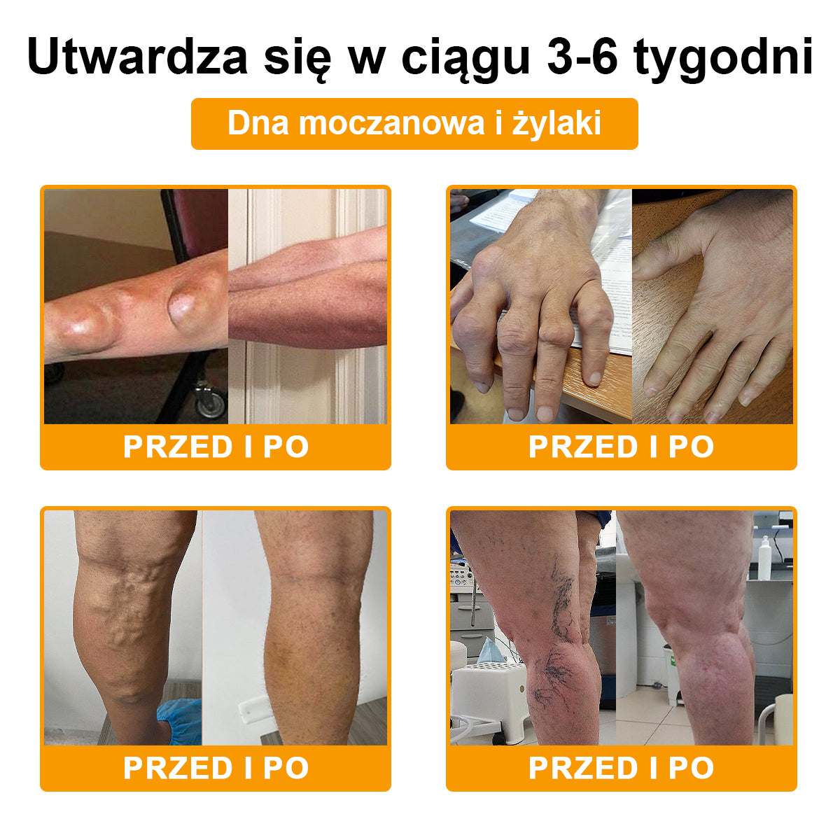 🐝TLOPA® Toksyna botulinowa i jad pszczeli Krem przeciwbólowy do gojenia kości🐝