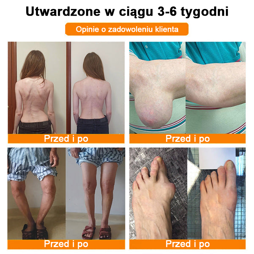 ✅Oficjalny sklep: Ouryard™ Olej magnezowy i miód w sprayu do naprawy stawów👨⚕️Zatwierdzony przez Polską Agencję Leków, Wyrobów Medycznych i Produktów Biologicznych (URPL)🔥