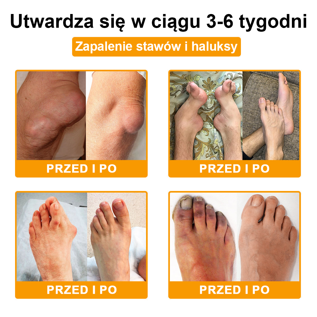 🐝TLOPA® Toksyna botulinowa i jad pszczeli Krem przeciwbólowy do gojenia kości🐝