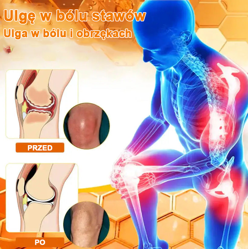 ✅Oficjalny sklep: Ouryard™ Olej magnezowy i miód w sprayu do naprawy stawów👨⚕️Zatwierdzony przez Polską Agencję Leków, Wyrobów Medycznych i Produktów Biologicznych (URPL)🔥