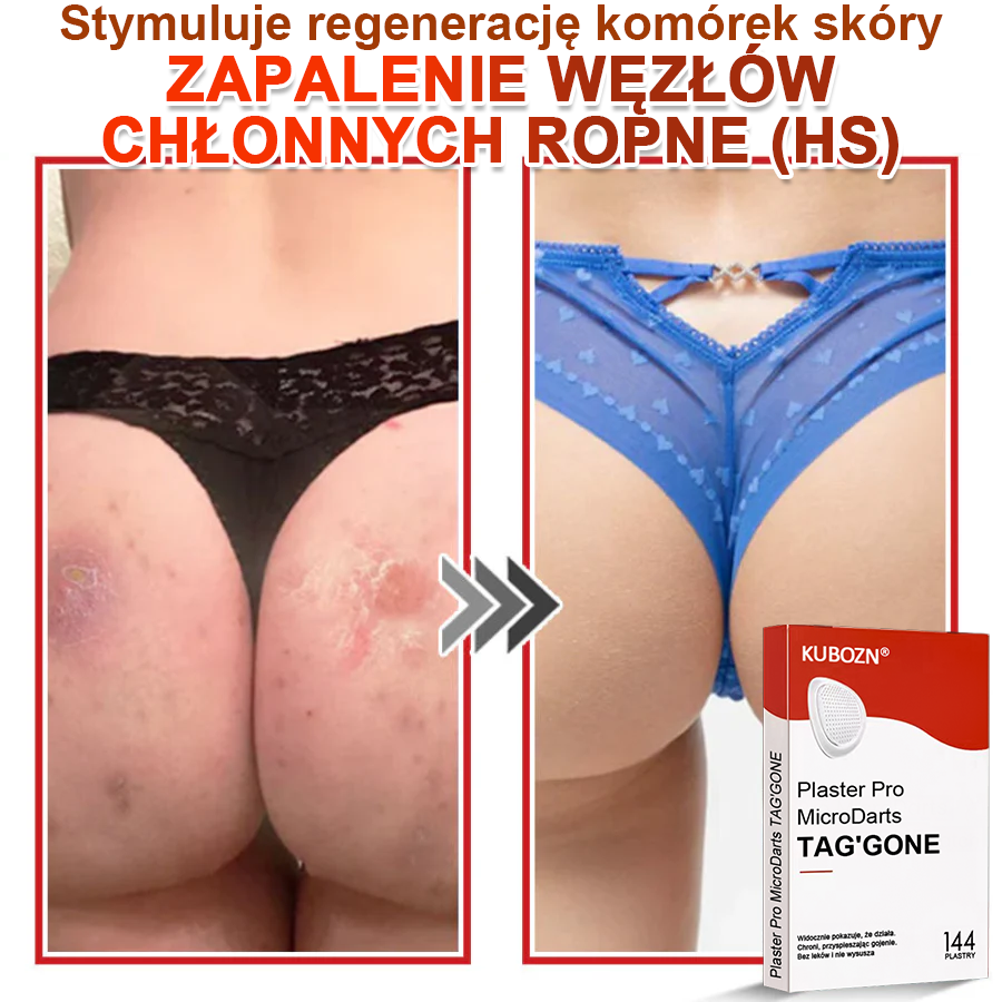 KUBOZN® Mikroigłowy Botaniczny Plaster na Usuwanie Brodawek Skórnych✨