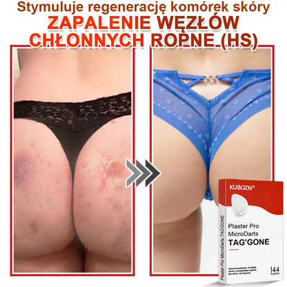 KUBOZN® Mikroigłowy Botaniczny Plaster na Usuwanie Brodawek Skórnych✨