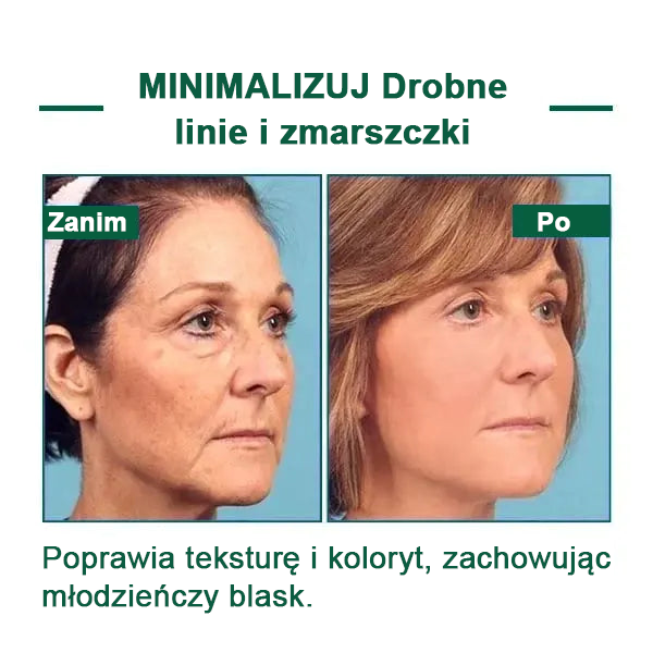 【✨Za pobraniem✨】Wyprzedaż ostatniego dnia 80% taniej - Ujędrniające serum regenerujące Fubsta™✨✨