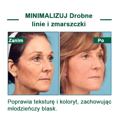 【✨Za pobraniem✨】Wyprzedaż ostatniego dnia 80% taniej - Ujędrniające serum regenerujące Fubsta™✨✨