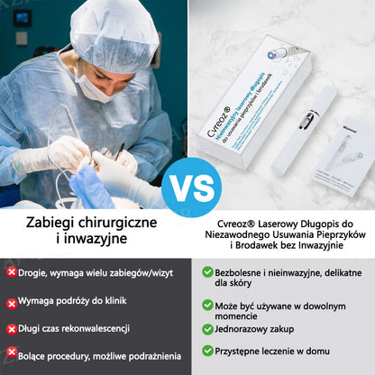Cvreoz® nowy nieinwazyjny laser do usuwania pieprzyków i brodawek
