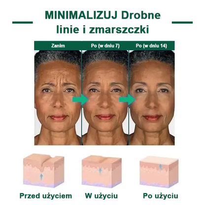【✨Za pobraniem✨】Wyprzedaż ostatniego dnia 80% taniej - Ujędrniające serum regenerujące Fubsta™✨✨