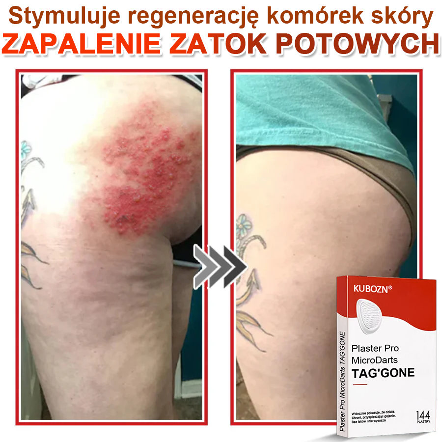KUBOZN® Mikroigłowy Botaniczny Plaster na Usuwanie Brodawek Skórnych✨