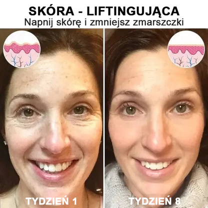 【✨Za pobraniem✨】Wyprzedaż ostatniego dnia 80% taniej - Ujędrniające serum regenerujące Fubsta™✨✨