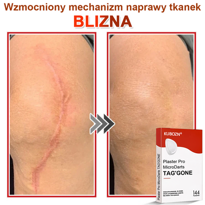 KUBOZN® Mikroigłowy Botaniczny Plaster na Usuwanie Brodawek Skórnych✨