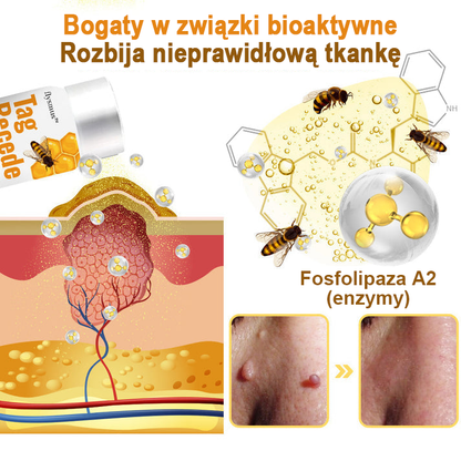 flysmus™ Sprej z jadem pszczelim do usuwania brodawek i znamion skórnych 🐝🐝🐝
