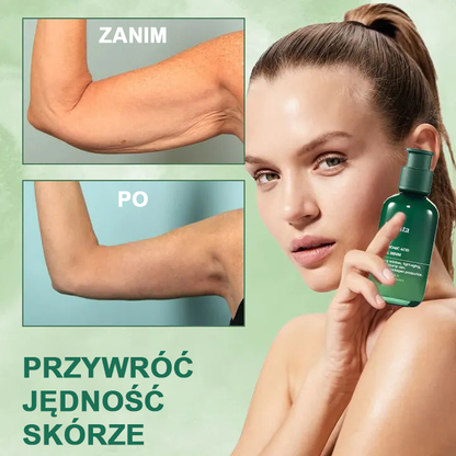 【✨Za pobraniem✨】Wyprzedaż ostatniego dnia 80% taniej - Ujędrniające serum regenerujące Fubsta™✨✨