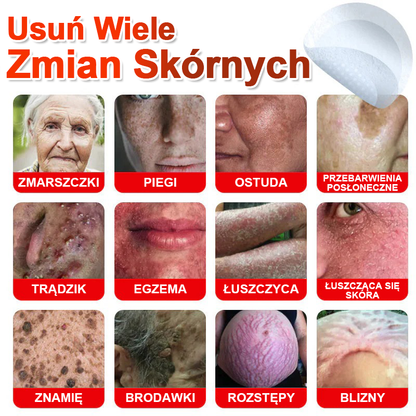 KUBOZN® Mikroigłowy Botaniczny Plaster na Usuwanie Brodawek Skórnych✨