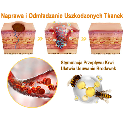 flysmus™ Sprej z jadem pszczelim do usuwania brodawek i znamion skórnych 🐝🐝🐝