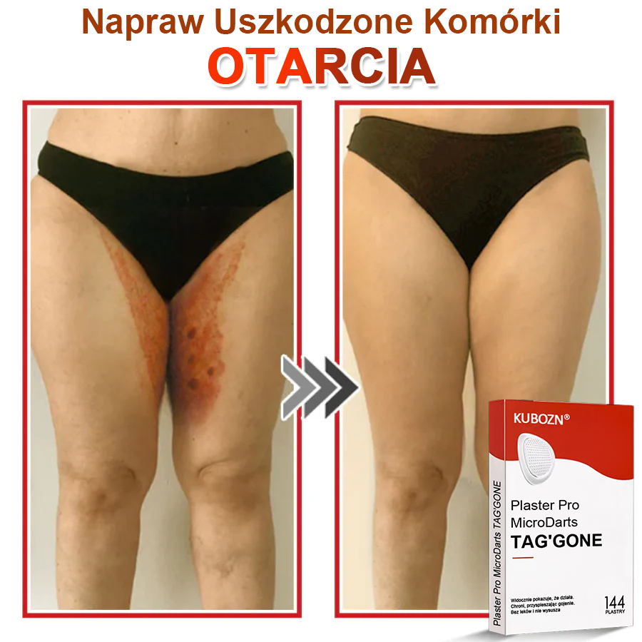 KUBOZN® Mikroigłowy Botaniczny Plaster na Usuwanie Brodawek Skórnych✨