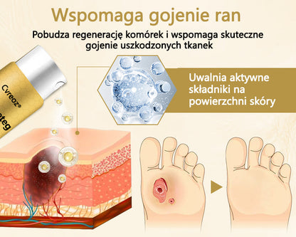 Cvreoz® Leczniczy spray z jadem pszczelim do gojenia i regeneracji ran na dłoniach i stopach🌿🌿