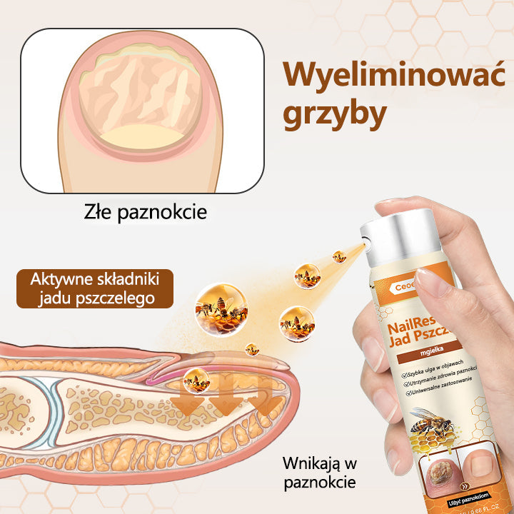 Spray z jadem pszczelim – skuteczny w leczeniu infekcji grzybiczych i zapalenia paznokci🎁🎁🎁