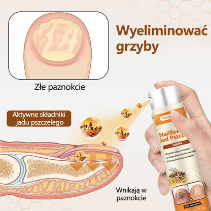 Spray z jadem pszczelim – skuteczny w leczeniu infekcji grzybiczych i zapalenia paznokci🎁🎁🎁