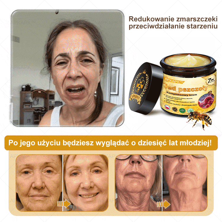 ΑPΚΑPK™ Jad Pszczoły Kompleksowy Krem🥇🥇pomaga w leczeniu problemów skórnych, takich jak: zmarszczki, blizny, plamy pigmentacyjne, rozstępy, trądzik, łuszczyca, egzema, zmiany skórne, podrażnienia, stany zapalne i inne problemy skórne🔥🔥