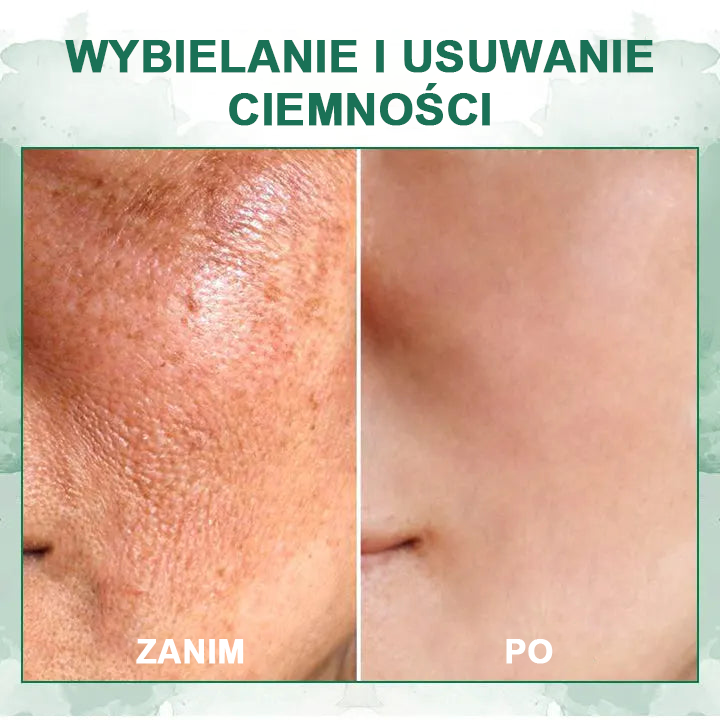 【✨Za pobraniem✨】Wyprzedaż ostatniego dnia 80% taniej - Ujędrniające serum regenerujące Fubsta™✨✨