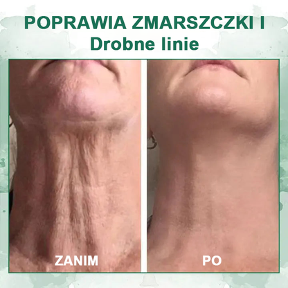 【✨Za pobraniem✨】Wyprzedaż ostatniego dnia 80% taniej - Ujędrniające serum regenerujące Fubsta™✨✨