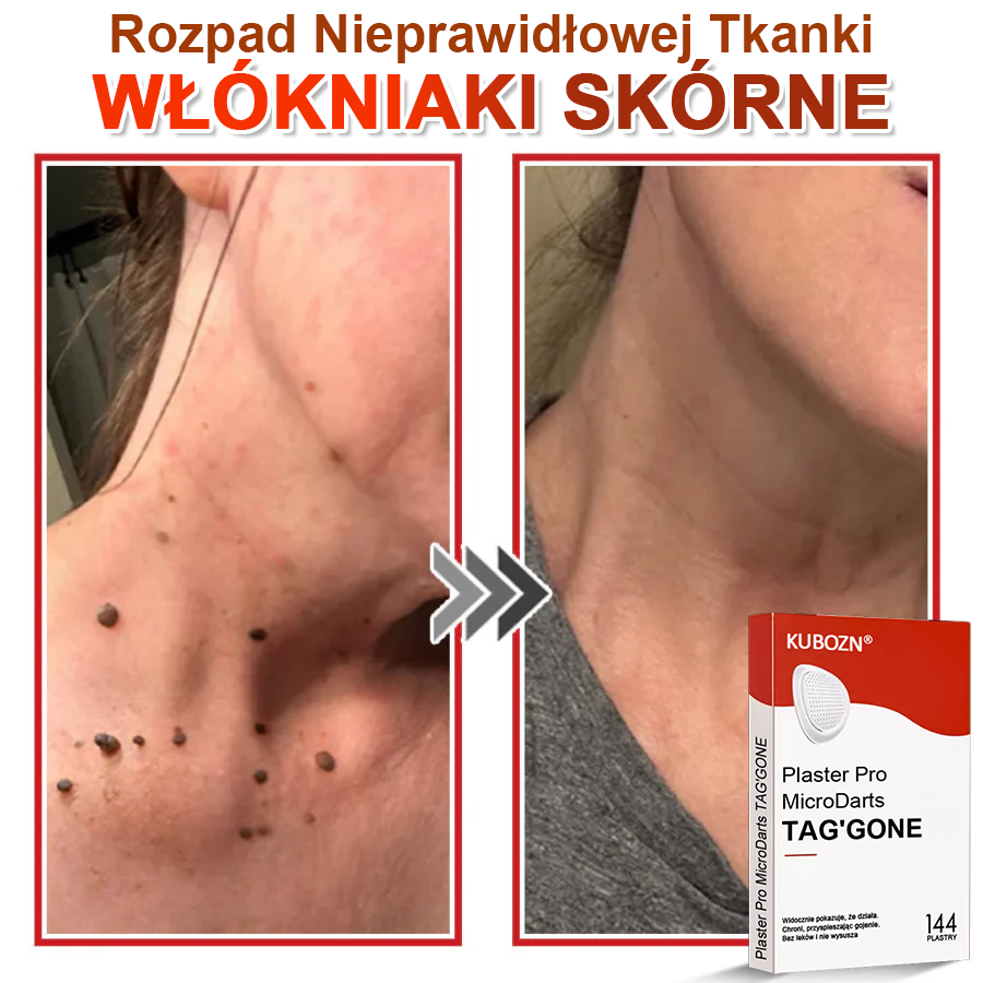 KUBOZN® Mikroigłowy Botaniczny Plaster na Usuwanie Brodawek Skórnych✨