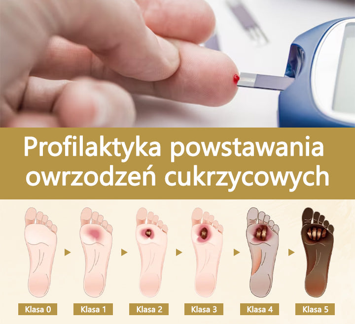 Cvreoz® Leczniczy spray z jadem pszczelim do gojenia i regeneracji ran na dłoniach i stopach🌿🌿