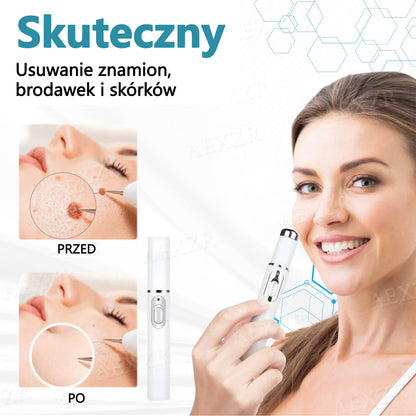 Cvreoz® nowy nieinwazyjny laser do usuwania pieprzyków i brodawek