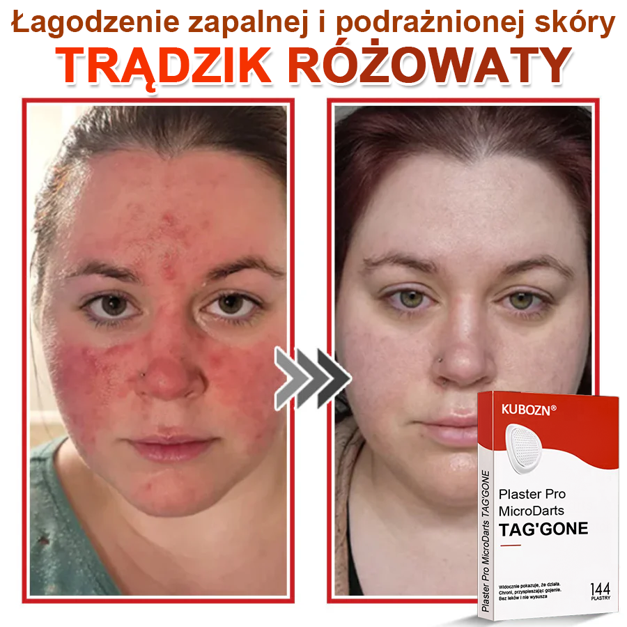 KUBOZN® Mikroigłowy Botaniczny Plaster na Usuwanie Brodawek Skórnych✨