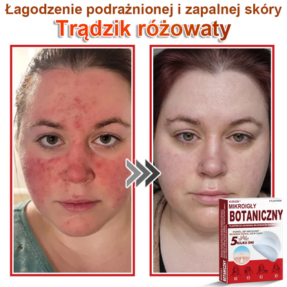 KUBOZN® Mikroigłowy botaniczny środek do usuwania narośli skórnych ✅✅✅wyprodukowano w Polsce