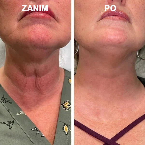【✨Za pobraniem✨】Wyprzedaż ostatniego dnia 80% taniej - Ujędrniające serum regenerujące Fubsta™✨✨