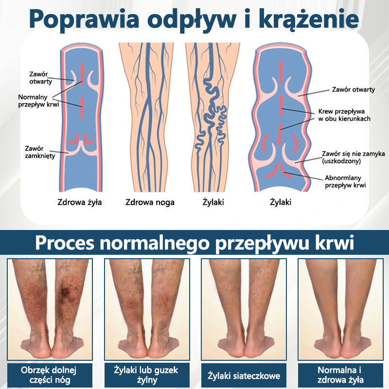 Detoksykujący krem ziołowy z czarnym kminkiem Cvreoz®🩹🩹🩹