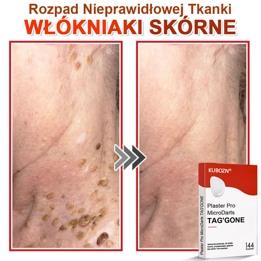 KUBOZN® Mikroigłowy Botaniczny Plaster na Usuwanie Brodawek Skórnych✨