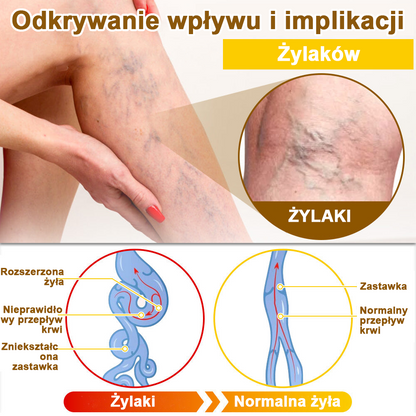 ✅flysmus™ Krem leczniczy z jadem pszczelim🐝: Leczenie egzemy, łuszczycy, trądziku, trądziku różowatego, infekcji grzybiczych, brodawek✅