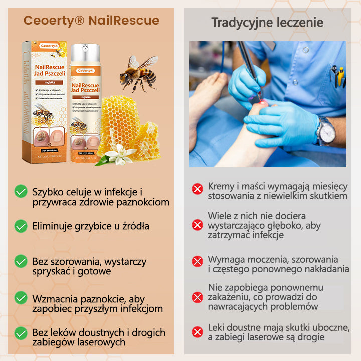 Spray z jadem pszczelim – skuteczny w leczeniu infekcji grzybiczych i zapalenia paznokci🎁🎁🎁