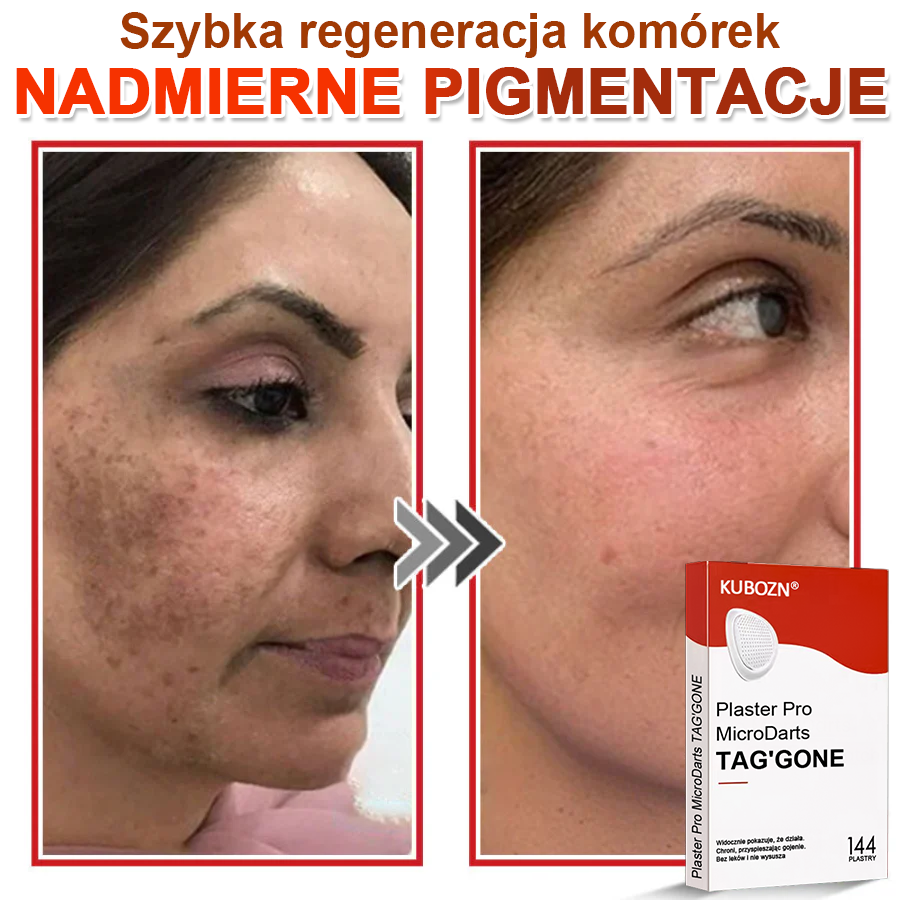 KUBOZN® Mikroigłowy Botaniczny Plaster na Usuwanie Brodawek Skórnych✨