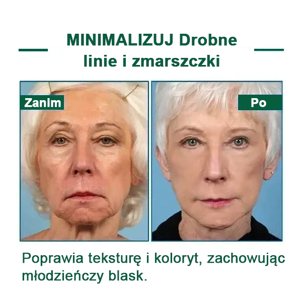 【✨Za pobraniem✨】Wyprzedaż ostatniego dnia 80% taniej - Ujędrniające serum regenerujące Fubsta™✨✨