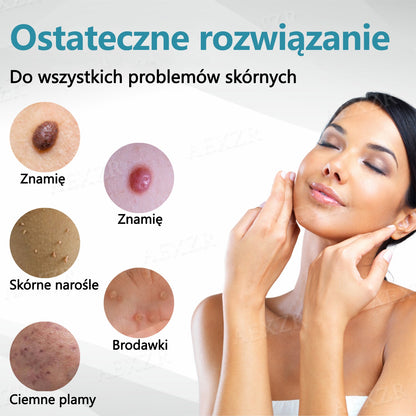 Cvreoz® nowy nieinwazyjny laser do usuwania pieprzyków i brodawek