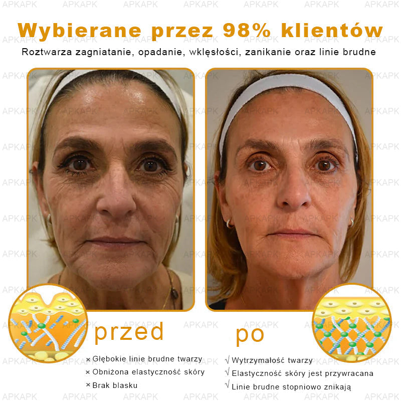ΑPΚΑPK™ Jad Pszczoły Kompleksowy Krem🥇🥇pomaga w leczeniu problemów skórnych, takich jak: zmarszczki, blizny, plamy pigmentacyjne, rozstępy, trądzik, łuszczyca, egzema, zmiany skórne, podrażnienia, stany zapalne i inne problemy skórne🔥🔥