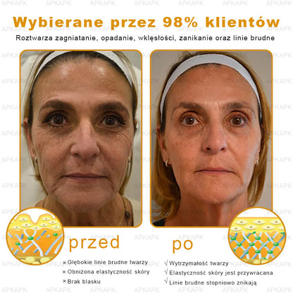 ΑPΚΑPK™ Jad Pszczoły Kompleksowy Krem🥇🥇pomaga w leczeniu problemów skórnych, takich jak: zmarszczki, blizny, plamy pigmentacyjne, rozstępy, trądzik, łuszczyca, egzema, zmiany skórne, podrażnienia, stany zapalne i inne problemy skórne🔥🔥